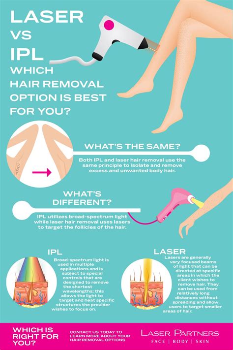 Magic lasre hair removal